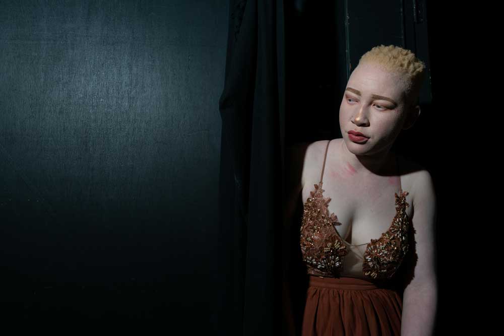 2.-15620-KCE-s-Eerste-Mr-and-Mrs-Albinism-schoonheidswedstrijd-in-Zuid-Afrika-MrMrsAlbinism-27
