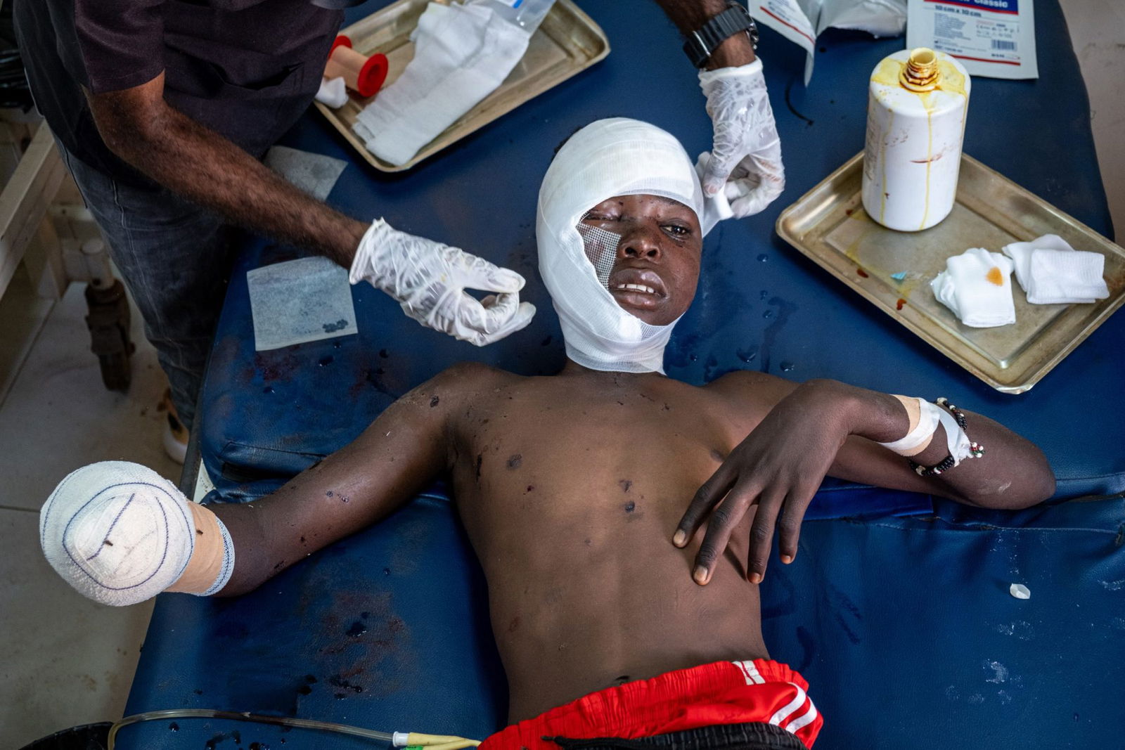 28475-NI-e-Mijnenveld Khartoem De zeventienjarige Malick verloor gisteren zijn rechterhand, toen hij tijdens het rapen van dadels een explosief oppakte. Er kwamen ook stukken scherf in zijn hoofd terecht.